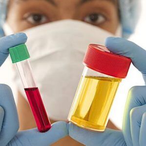 Blut- und Urintests für Diabetes