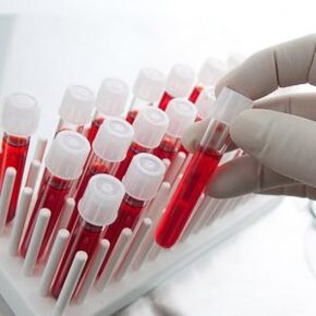 Blutuntersuchungen für Diabetes